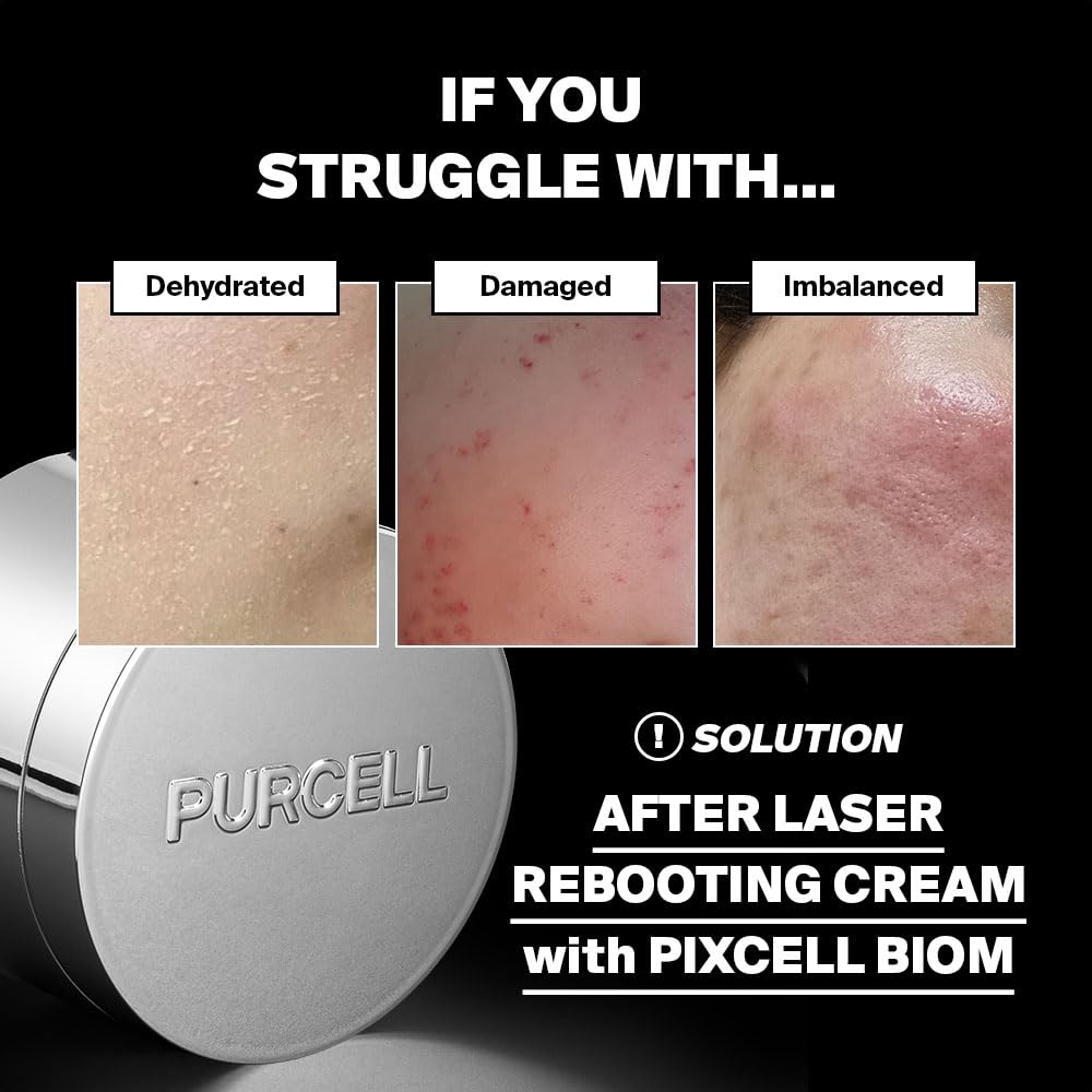 PIXCELL BIOM™ After Laser Rebooting Cream for Probiotic Barrier Recovery with Niacinamide, Panthenol, Suitable for Sensitive Skin, 1.69 fl oz(50ml)